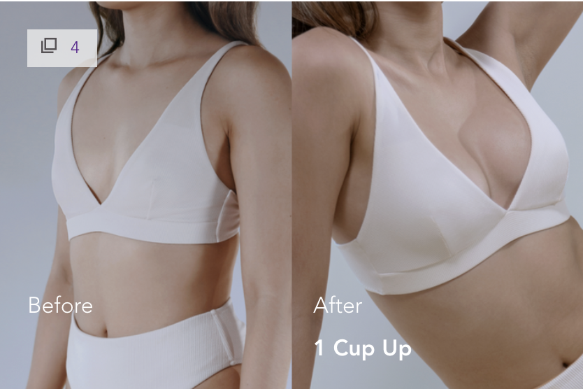 mia-femtech-breast-implant-harmonization-istanbul-2 İstanbul Mia Femtech Meme Estetiği